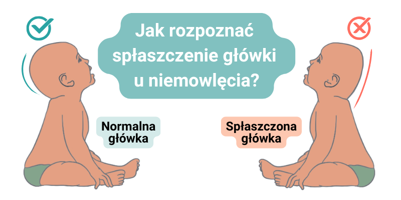 Jak zapobiec płaskiej główce u niemowlęcia? Fizjoterapeuta wyjaśnia